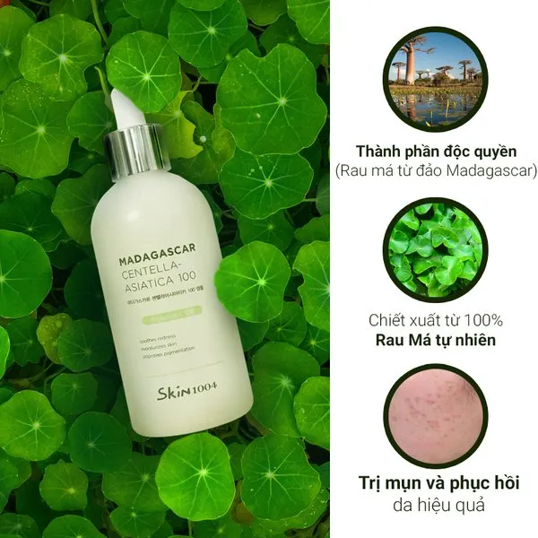Skin1004 Madagascar Centella Ampoule ưu nhược điểm review thực tế người dùng Việt Nam da nhạy cảm mụn